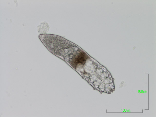 Demodex Brevis